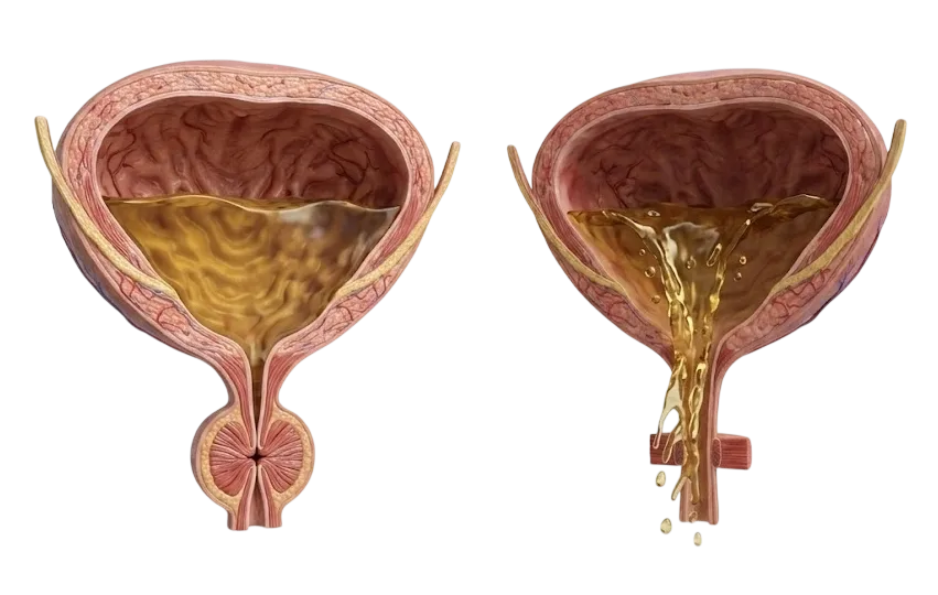 Лечение недержания мочи у мужчин и женщин в КДС Клиник