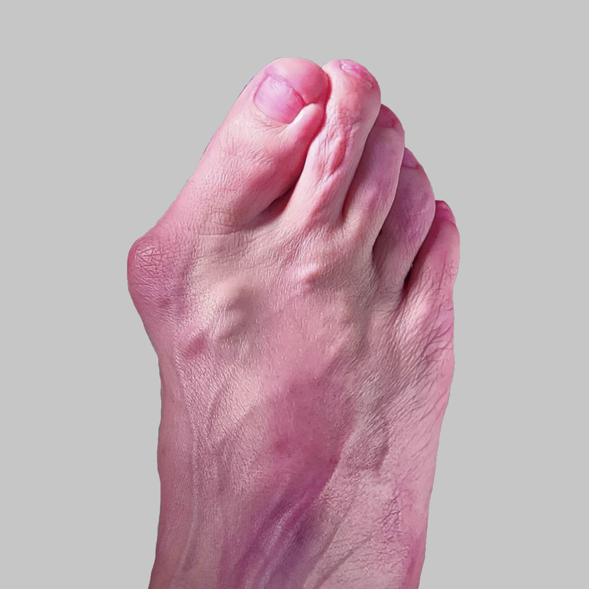 До