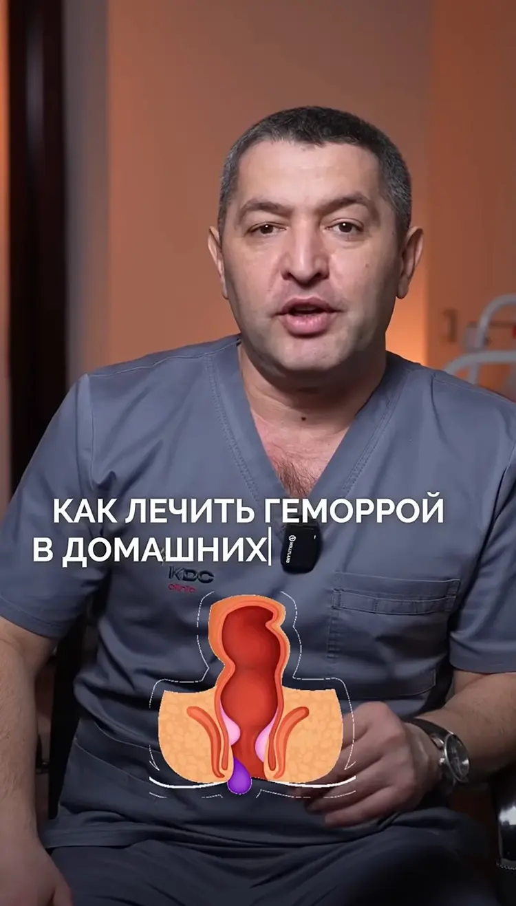 Как лечить геморрой в домашних условиях? 🤫