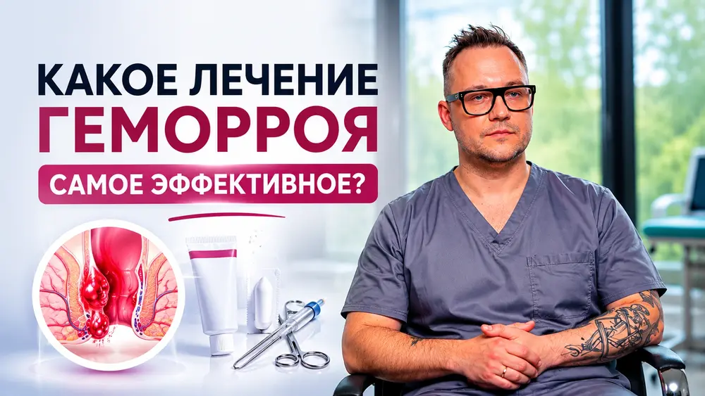 Какое лечение геморроя является самым эффективным? 🤔